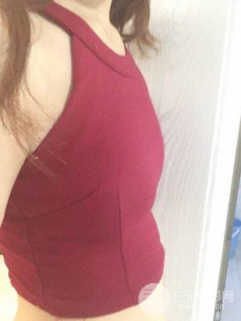 假體隆胸術后成功擺脫小學生身材,立現性感身材