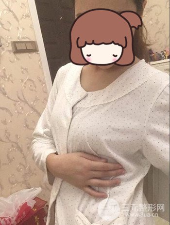 假體隆胸術后成功擺脫小學生身材,立現性感身材