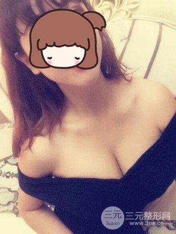 假體隆胸術后成功擺脫小學生身材,立現性感身材