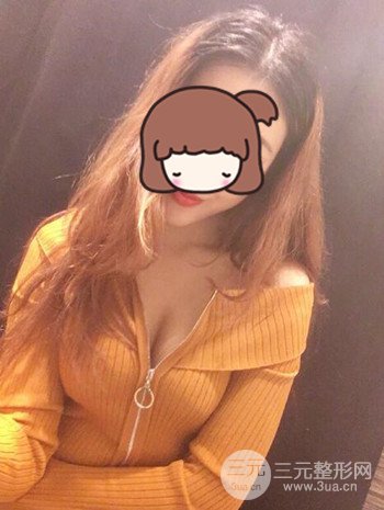 假體隆胸術后成功擺脫小學生身材,立現性感身材