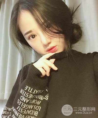 做了隆鼻整形成功落實(shí)精致小巧鼻 附上果圖