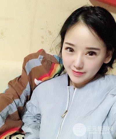 做了隆鼻整形成功落實(shí)精致小巧鼻 附上果圖