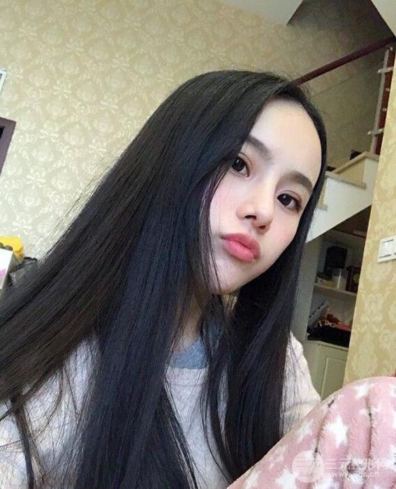 成都大華隆鼻怎么樣?真實案例前后對比圖記錄恢復(fù)過程