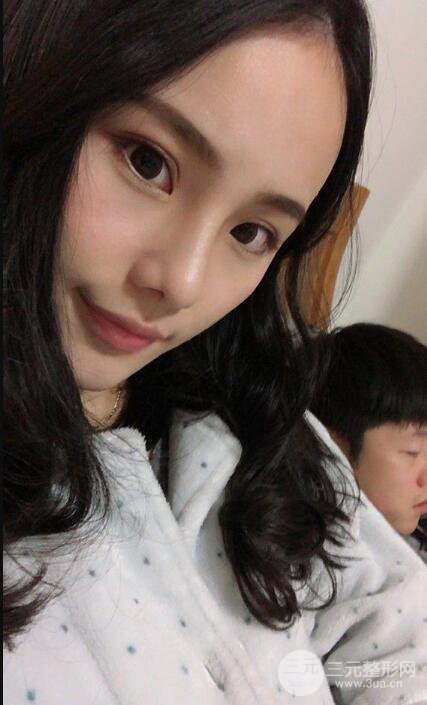 成都大華隆鼻怎么樣?真實案例前后對比圖記錄恢復(fù)過程