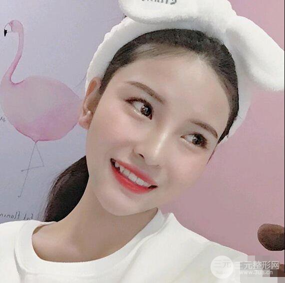 成都華西醫(yī)院整形美容科卿勇隆鼻整形前后對(duì)比圖恢復(fù)心情小札
