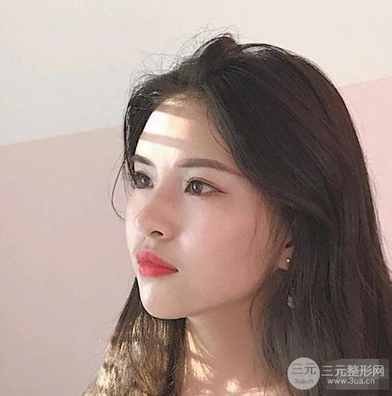 成都華西醫(yī)院整形美容科卿勇隆鼻整形前后對(duì)比圖恢復(fù)心情小札