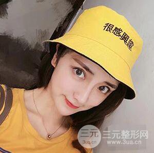 杭州格萊美張樹功假體隆鼻前后對比圖|內(nèi)附恢復(fù)心情變化哦