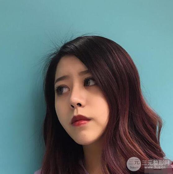 重慶華美何春濤硅膠隆鼻前后對(duì)比圖 內(nèi)附恢復(fù)心情小札