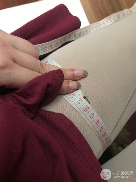 德陽東美奧克拉楊華博大腿吸脂前對(duì)對(duì)比圖 四個(gè)月恢復(fù)變化小記