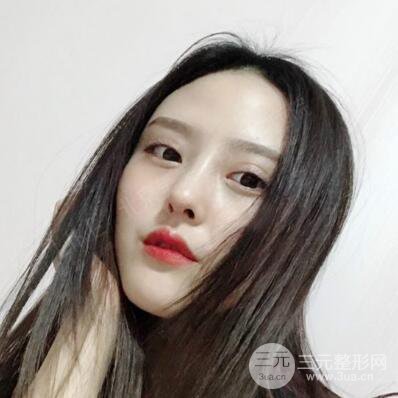 北京美萊趙峻賢隆鼻整形真實案例對比圖恢復(fù)過程分享