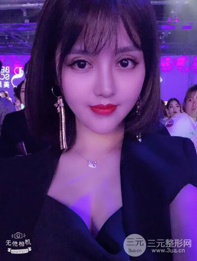 常州施爾美廉鋒自體脂肪豐臉對(duì)照?qǐng)D案例心情日扎