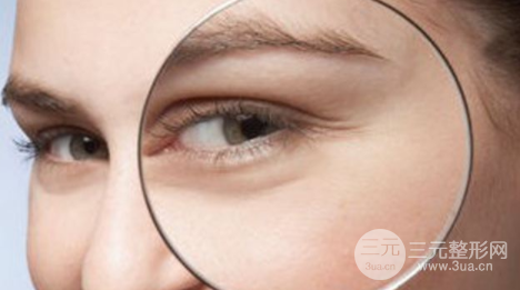 魚尾紋除皺術(shù)