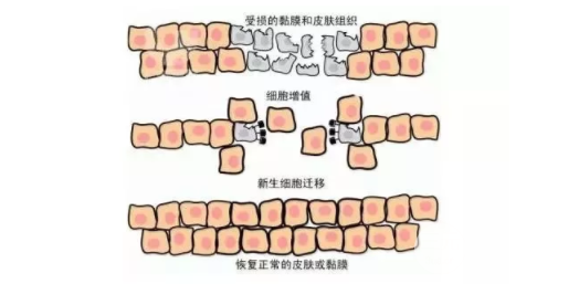 誰(shuí)做過(guò)彩光嫩膚有果嗎 誰(shuí)做過(guò)彩光嫩膚有果嗎