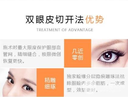 什么是切開雙眼皮?