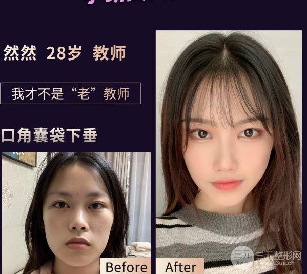 熱瑪吉的緩解過程