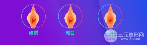 處女膜修復(fù)時(shí)機(jī)