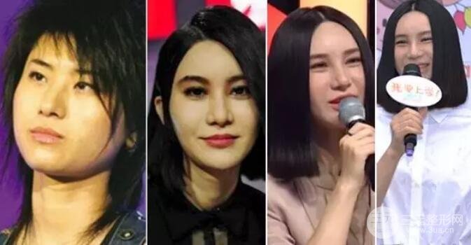 尚雯婕整容前后照片對(duì)比