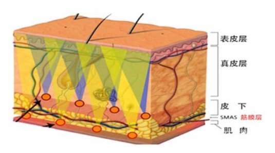熱瑪吉費(fèi)用詳解