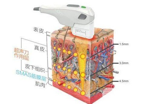 美版熱拉提和韓版的區(qū)別