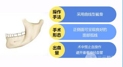 磨下頜角手術(shù)價格