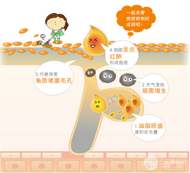 水楊酸祛痘的原理