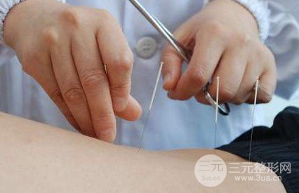 去除面部紅血絲的方法