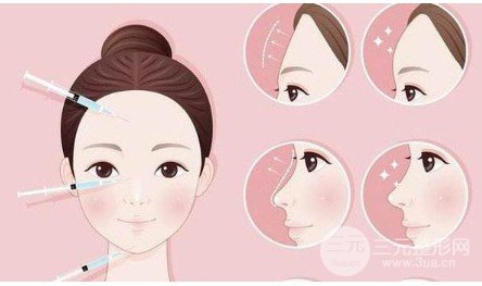 額頭整形術(shù)前后圖片