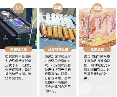 吸脂減肥價格貴不貴