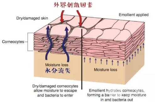 來了！你的敏感皮膚“自救”指南