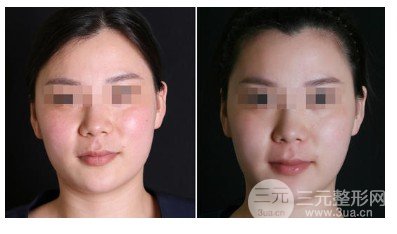 熱瑪吉原理及作用