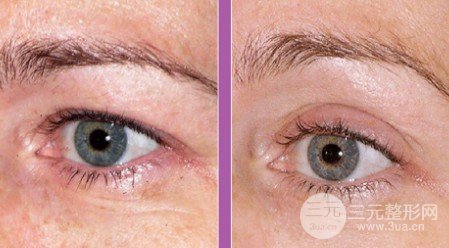 熱拉提和熱瑪吉區(qū)別