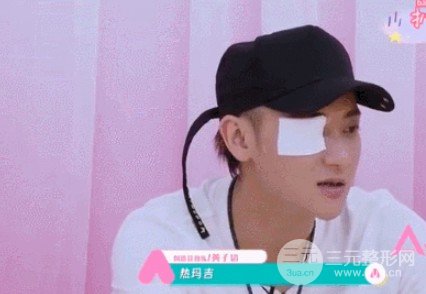 熱瑪吉和埋線除皺哪個好