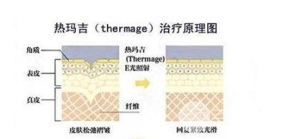 為什么有些人在完成熱瑪吉后沒(méi)有果?