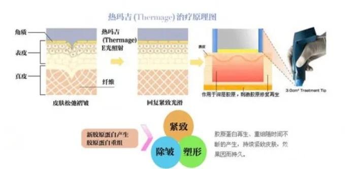 熱瑪吉的恢復(fù)期