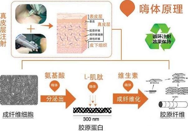 嗨體