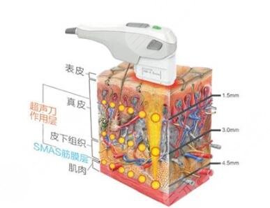 熱瑪吉的技術(shù)特點(diǎn)