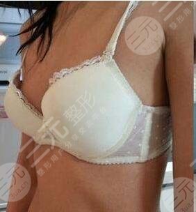 北京協(xié)會(huì)右安門醫(yī)院整形美容科