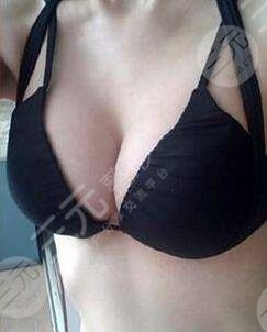 北京協(xié)會(huì)右安門醫(yī)院整形美容科