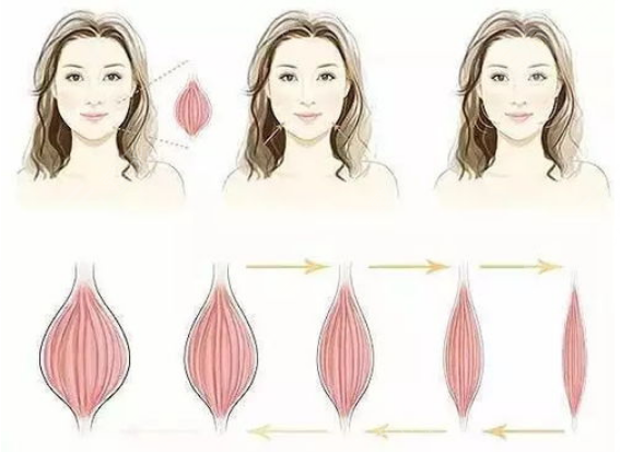 注射瘦臉是打50還是100劑量？每個人面部情況不一樣，可別在稀里糊涂啦！