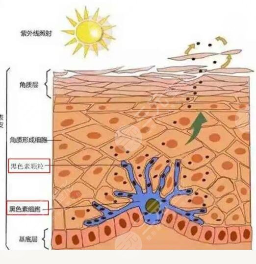 黃褐斑較為頑固