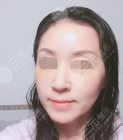 面部年輕化plus全臉，快速解決面部問(wèn)題，內(nèi)附真實(shí)案例分享圖