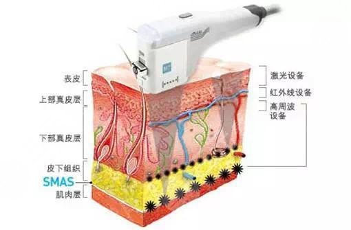 臉上紅血絲如何去除？怎么修復(fù)？