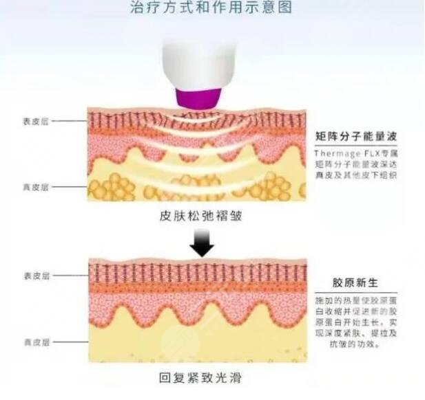 做熱瑪吉的價格是多少