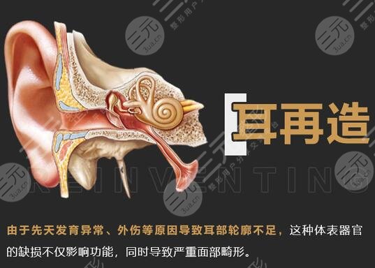 耳再造多少費用？價格參考&手術(shù)科普，耳整形避雷指南！