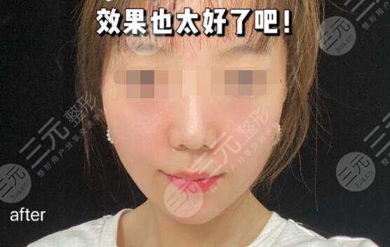 抗衰后