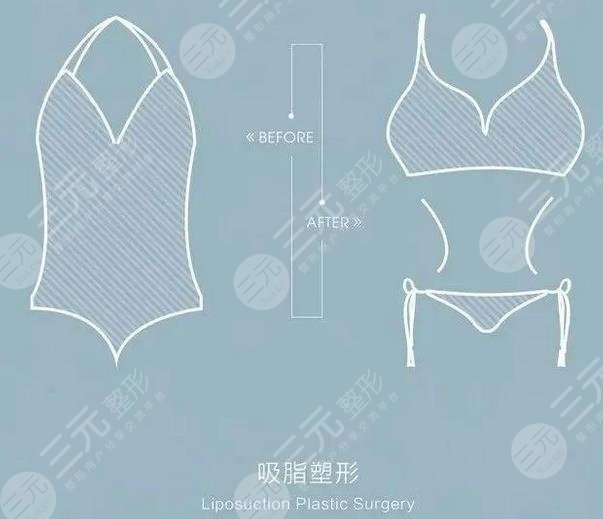 網(wǎng)絡(luò)瘋傳的超脂塑吸脂到底啥來(lái)頭