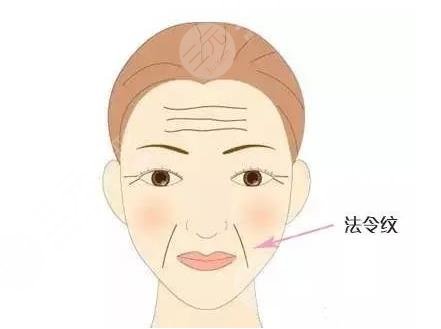 有法令紋怎么辦？去法令紋價格大概多少錢？附價格表