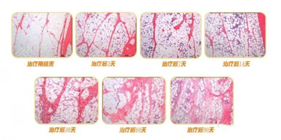 超脂塑塑型果維持時間久嗎?