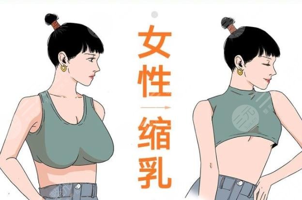 棒棒糖縮胸手術(shù)的恢復(fù)時(shí)間