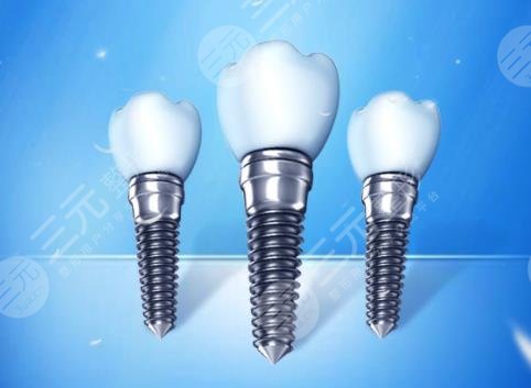 影響牙齒種植手術(shù)的價格因素有哪些呢